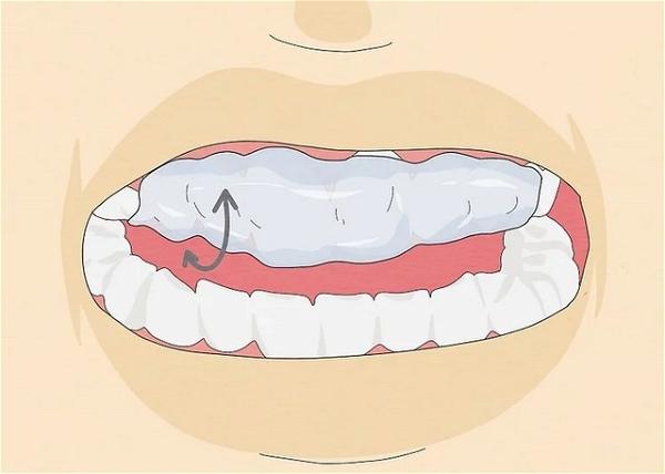 How To Make A Fake Retainer With Wax